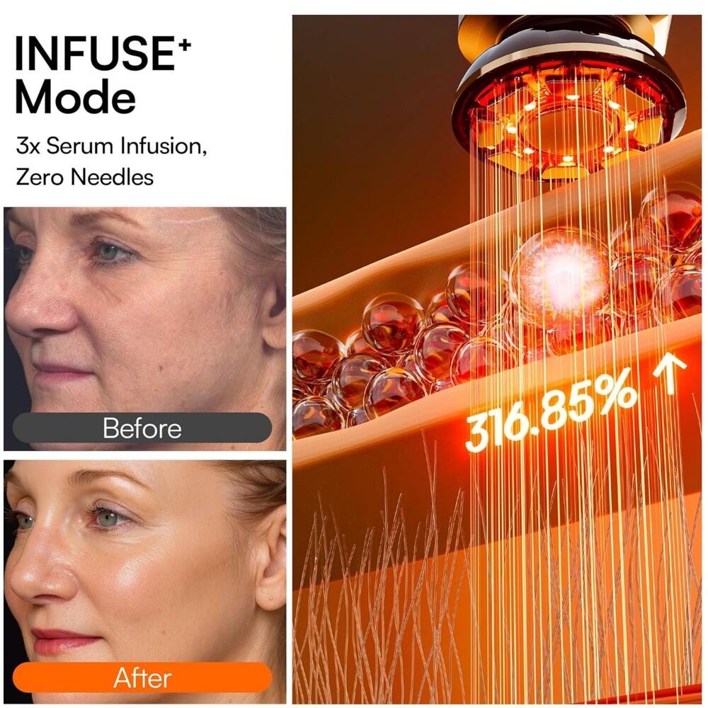 INIA FLARE 3-in-1 Red Light Microcurrent Facial Beauty Device + Gel - Picture 4 of 8